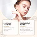 Acne Skin Care Moisturizing Essence