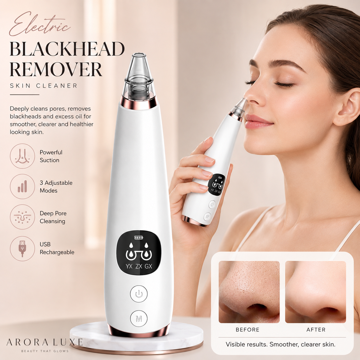 Electric Blackhead Remover