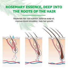 Rosemary Hair Growth Scalp Treatment Oil