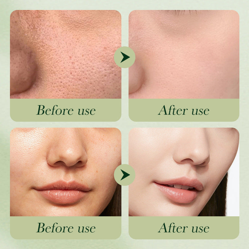 Sadoer Avocado Moisturising 6-Piece Skincare Set