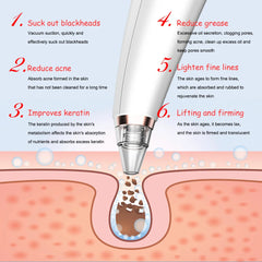 Electric Blackhead Remover
