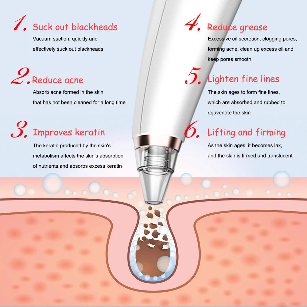 Electric Blackhead Remover